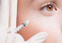 注射除皱