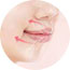 唇外翻修复